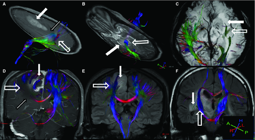 Details are in the caption following the image Details are in the caption following the image