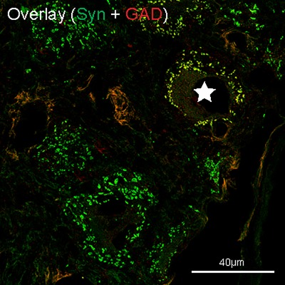 GABAergic innervation of the ciliary ganglion in macaque monkeys – A light and electron microscopic study
