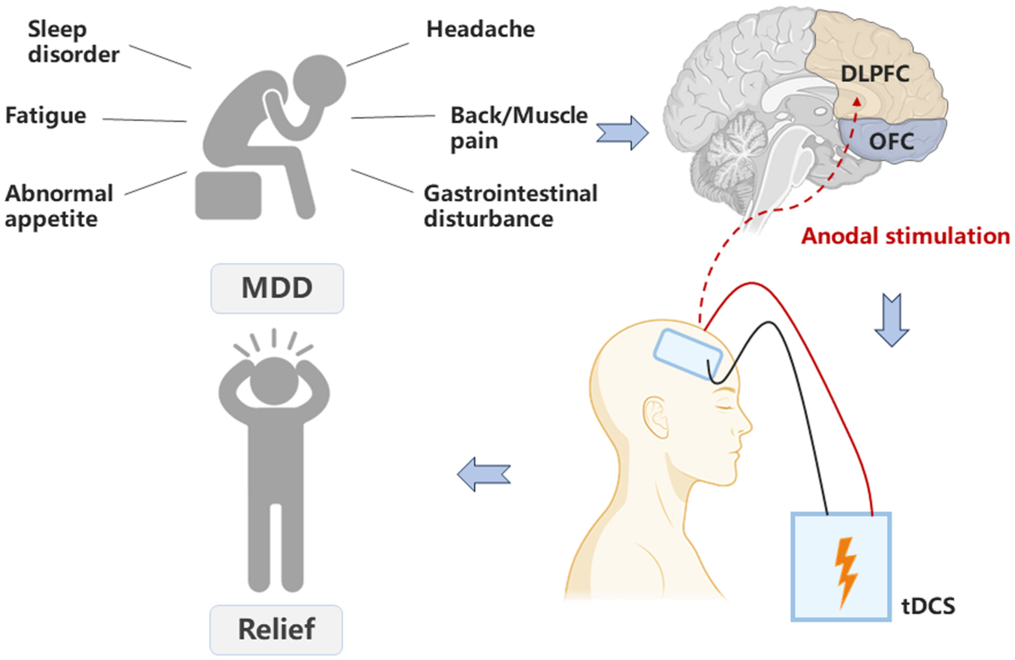 Effects of Transcranial Direct Current Stimulation Targeting Dorsolateral Prefrontal Cortex and Orbitofrontal Cortex on Somatic Symptoms in Patients With Major Depressive Disorder: A Randomized, Double-Blind, Controlled Clinical Trial