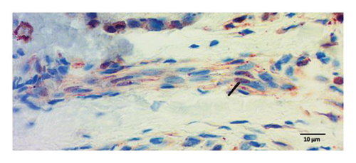 Details are in the caption following the image