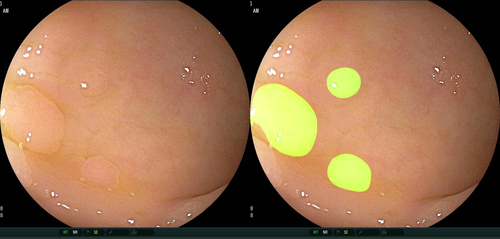 Details are in the caption following the image Details are in the caption following the image