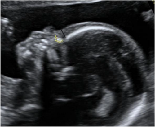 Details are in the caption following the image