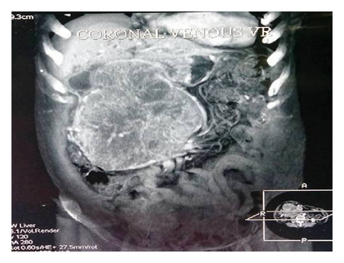 Details are in the caption following the image