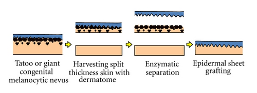 Details are in the caption following the image