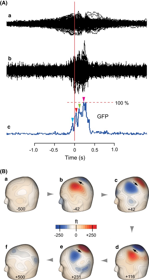Reappraisal of field dynamics of motor cortex during self-paced finger movements