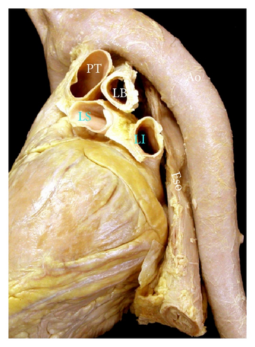 Details are in the caption following the image