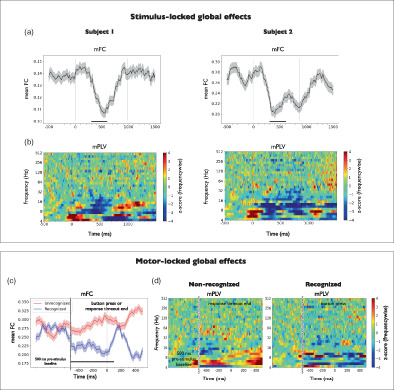 Assessing the coupling between local neural activity and global connectivity fluctuations: Application to human intracranial electroencephalography during a cognitive task