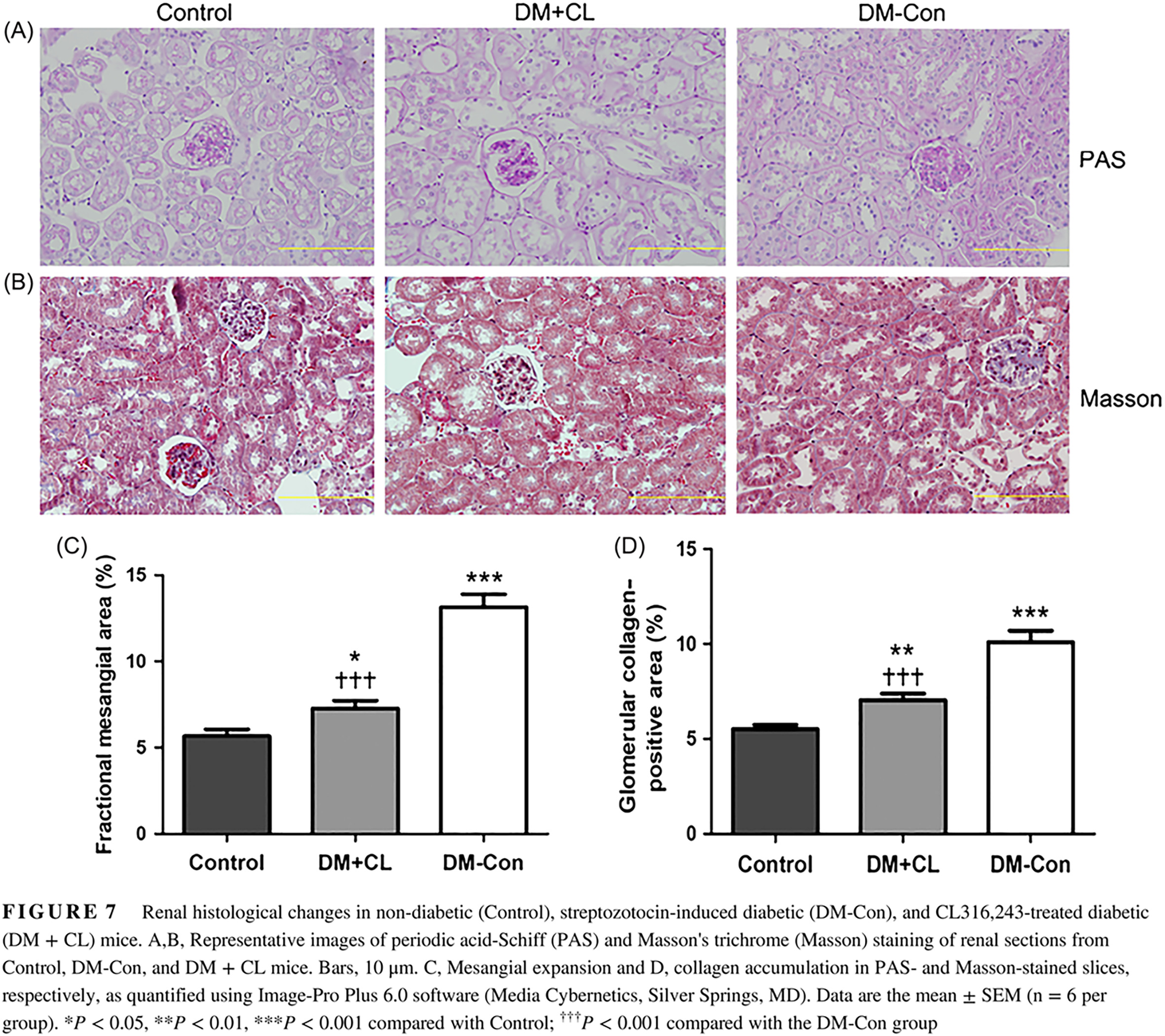 Renoprotective effects of brown adipose tissue activation in diabetic mice 棕色脂肪激活对糖尿病小鼠的肾脏保护作用