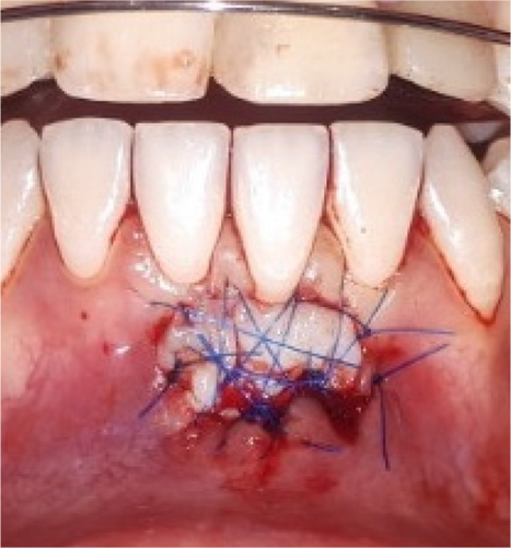 Details are in the caption following the image Details are in the caption following the image