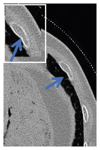 Details are in the caption following the image