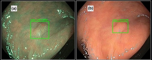 Details are in the caption following the image Details are in the caption following the image