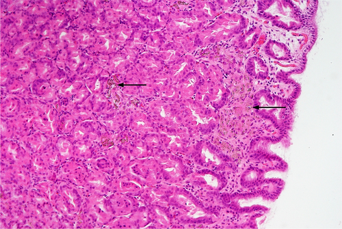 Details are in the caption following the image