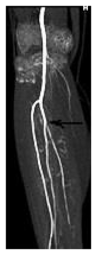 Details are in the caption following the image