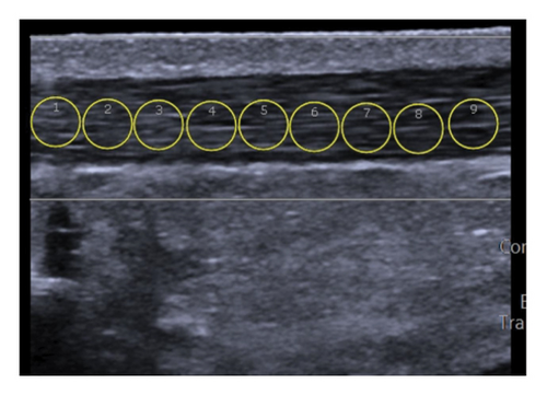 Details are in the caption following the image Details are in the caption following the image