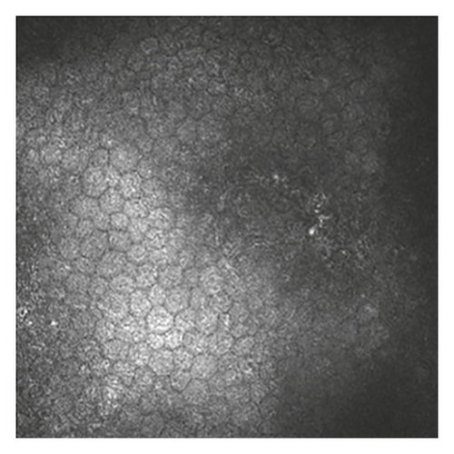 Details are in the caption following the image