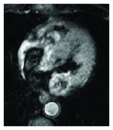 Details are in the caption following the image