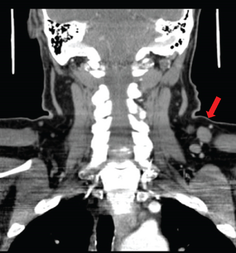 Details are in the caption following the image
