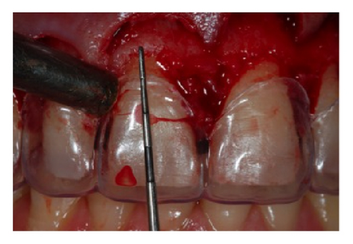 Details are in the caption following the image Details are in the caption following the image
