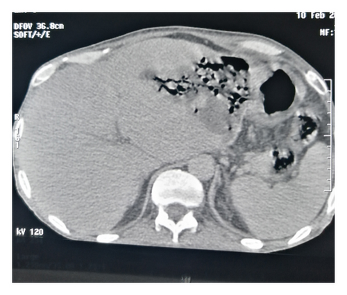 Details are in the caption following the image Details are in the caption following the image
