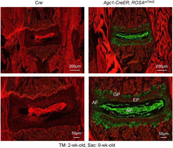 Runx2 is required for postnatal intervertebral disc tissue growth and development