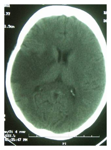 Details are in the caption following the image