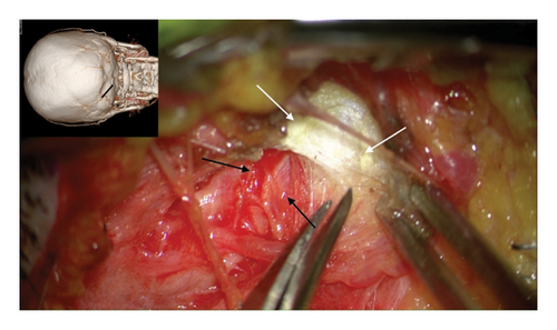 Details are in the caption following the image Details are in the caption following the image