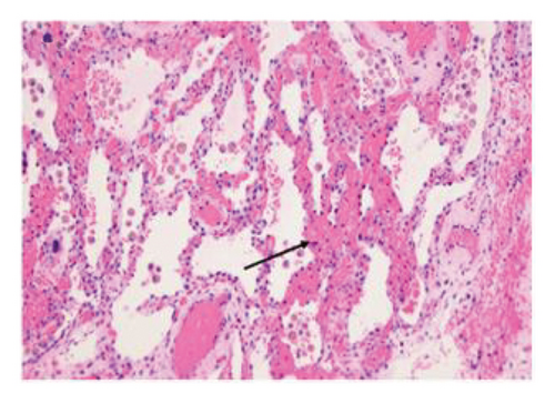 Details are in the caption following the image