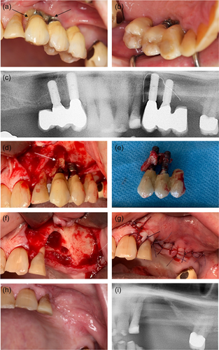 Details are in the caption following the image Details are in the caption following the image
