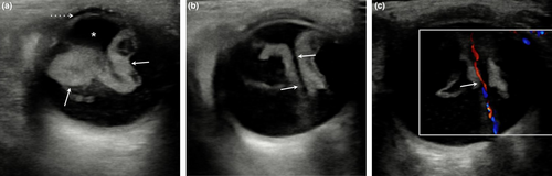 Details are in the caption following the image