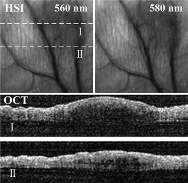 Optical coherence hyperspectral microscopy with a single supercontinuum light source