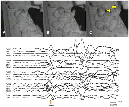 Details are in the caption following the image Details are in the caption following the image