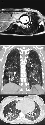 Details are in the caption following the image Details are in the caption following the image