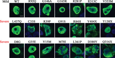 Mutant NR5A1/SF-1 in patients with disorders of sex development shows defective activation of the SOX9 TESCO enhancer