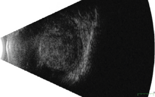 Details are in the caption following the image