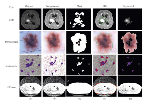 Details are in the caption following the image Details are in the caption following the image