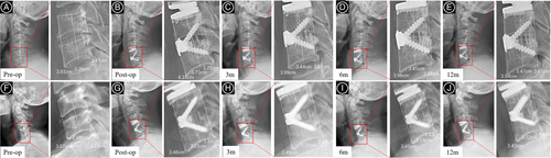 Details are in the caption following the image Details are in the caption following the image