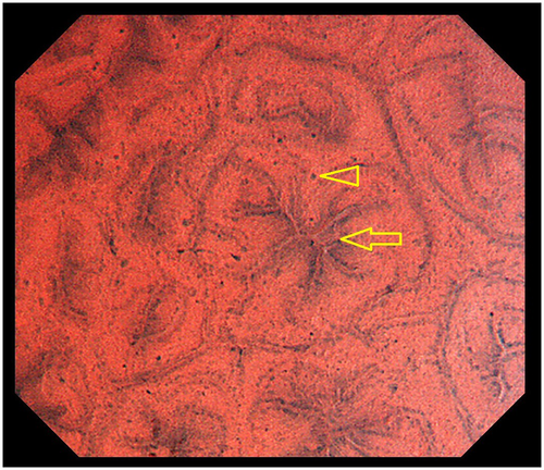Details are in the caption following the image Details are in the caption following the image