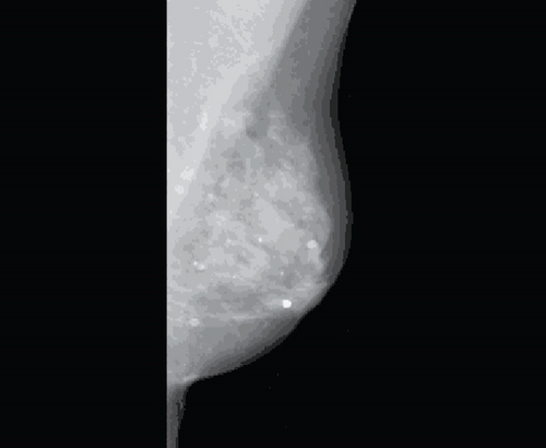 Details are in the caption following the image