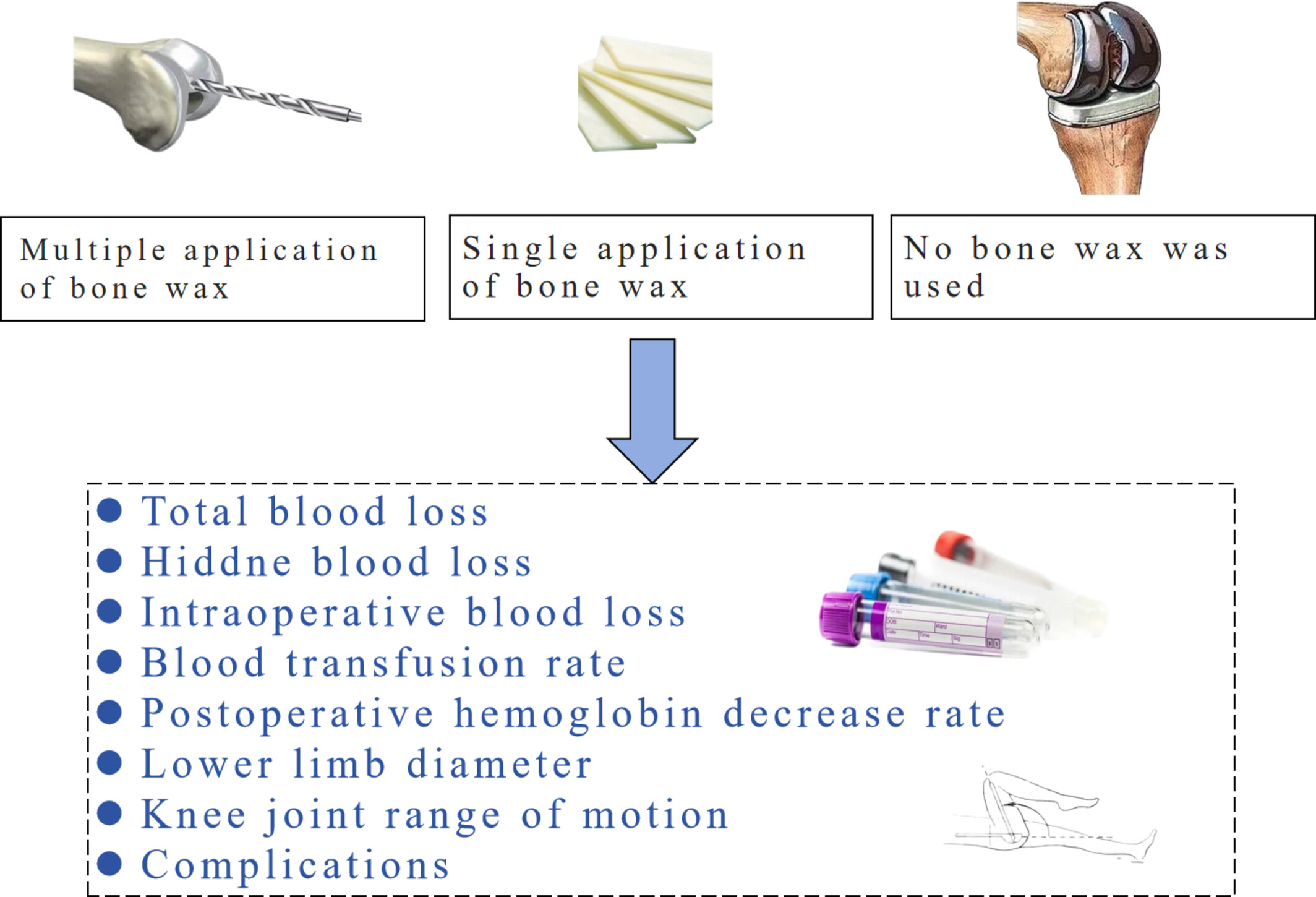 Efficacy and Safety of Bone Wax Application at Different Time Points to Reduce Postoperative Blood Loss in Total Knee Arthroplasty: A Prospective Randomized Controlled Trial