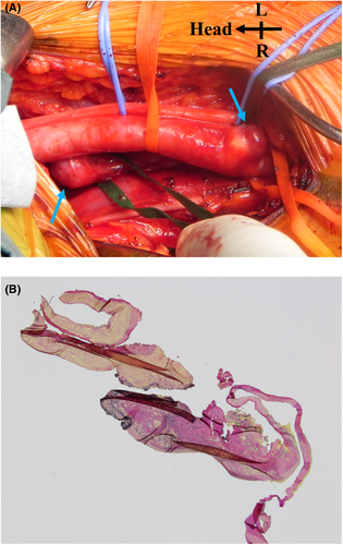 Details are in the caption following the image Details are in the caption following the image