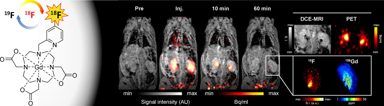 A Macrocyclic Hybrid PET/MRI Probe for Quantitative Perfusion Imaging In Vivo
