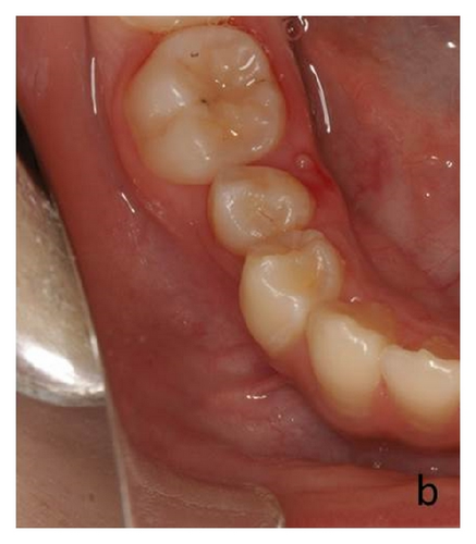 Details are in the caption following the image