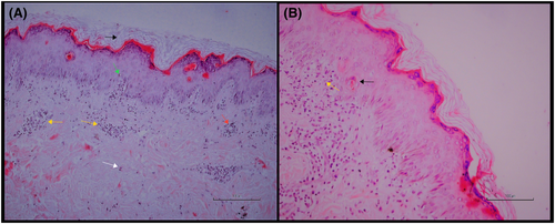 Details are in the caption following the image Details are in the caption following the image