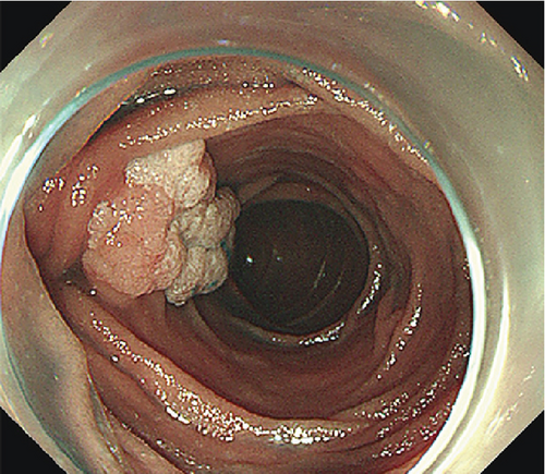 Details are in the caption following the image Details are in the caption following the image