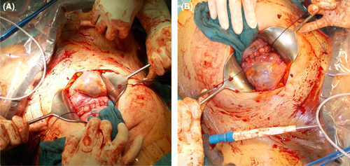 Details are in the caption following the image Details are in the caption following the image