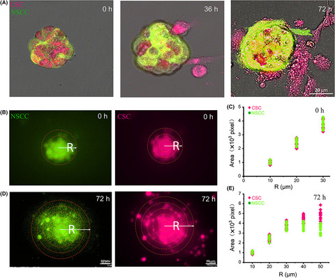 Cancer stem-like cells with hybrid epithelial/mesenchymal phenotype leading the collective invasion