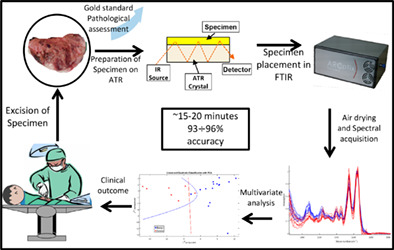 Rapid intraoperative diagnosis of gynecological cancer by ATR-FTIR spectroscopy of fresh tissue biopsy