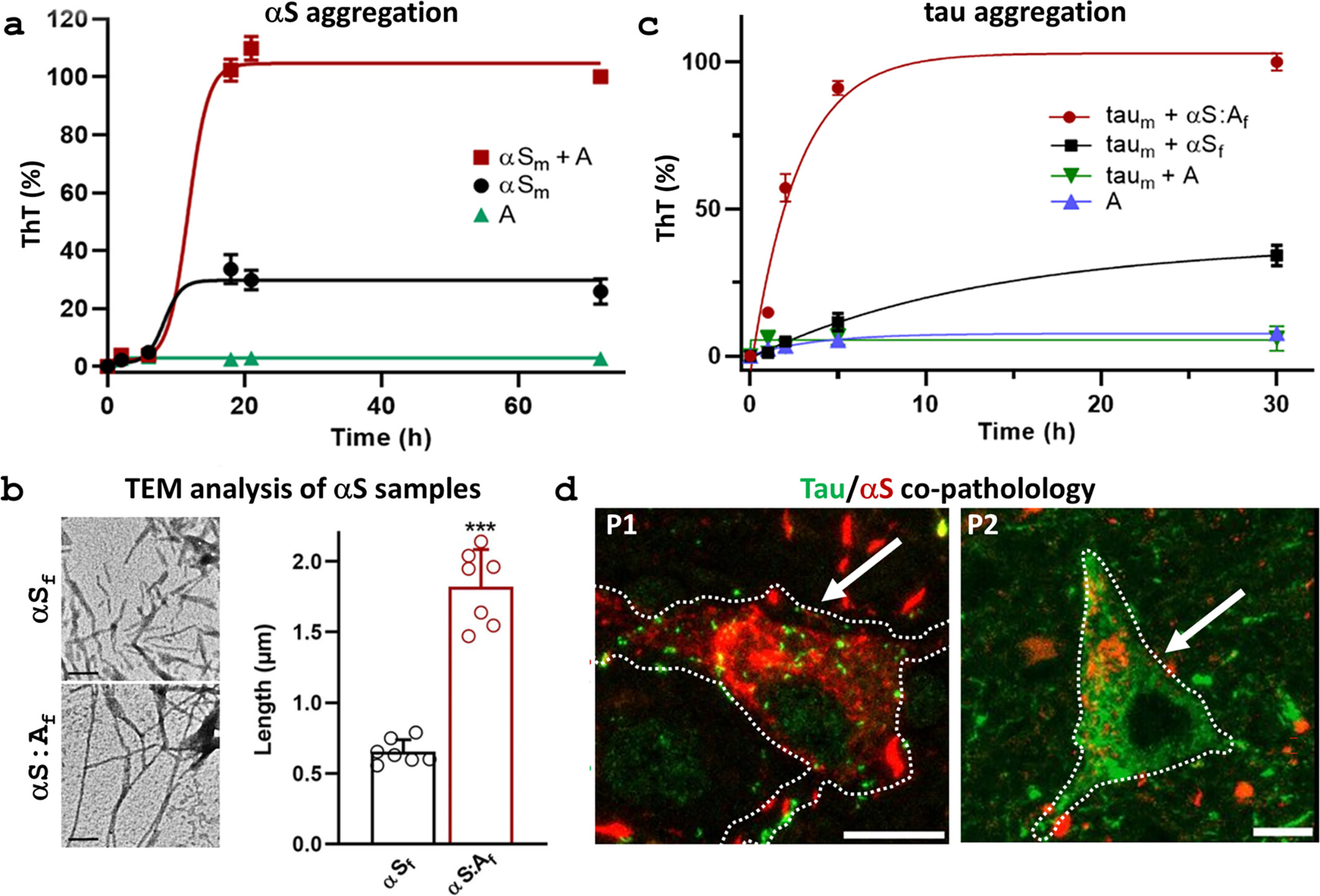 Protein Coaggregation in Caribbean Atypical Parkinsonism: The Contribution of Annonacin