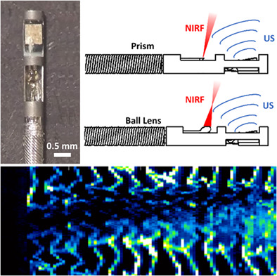Intravascular molecular-structural imaging with a miniaturized integrated near-infrared fluorescence and ultrasound catheter