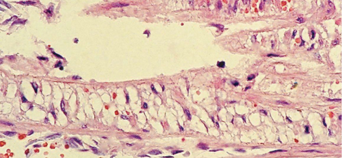 Details are in the caption following the image
